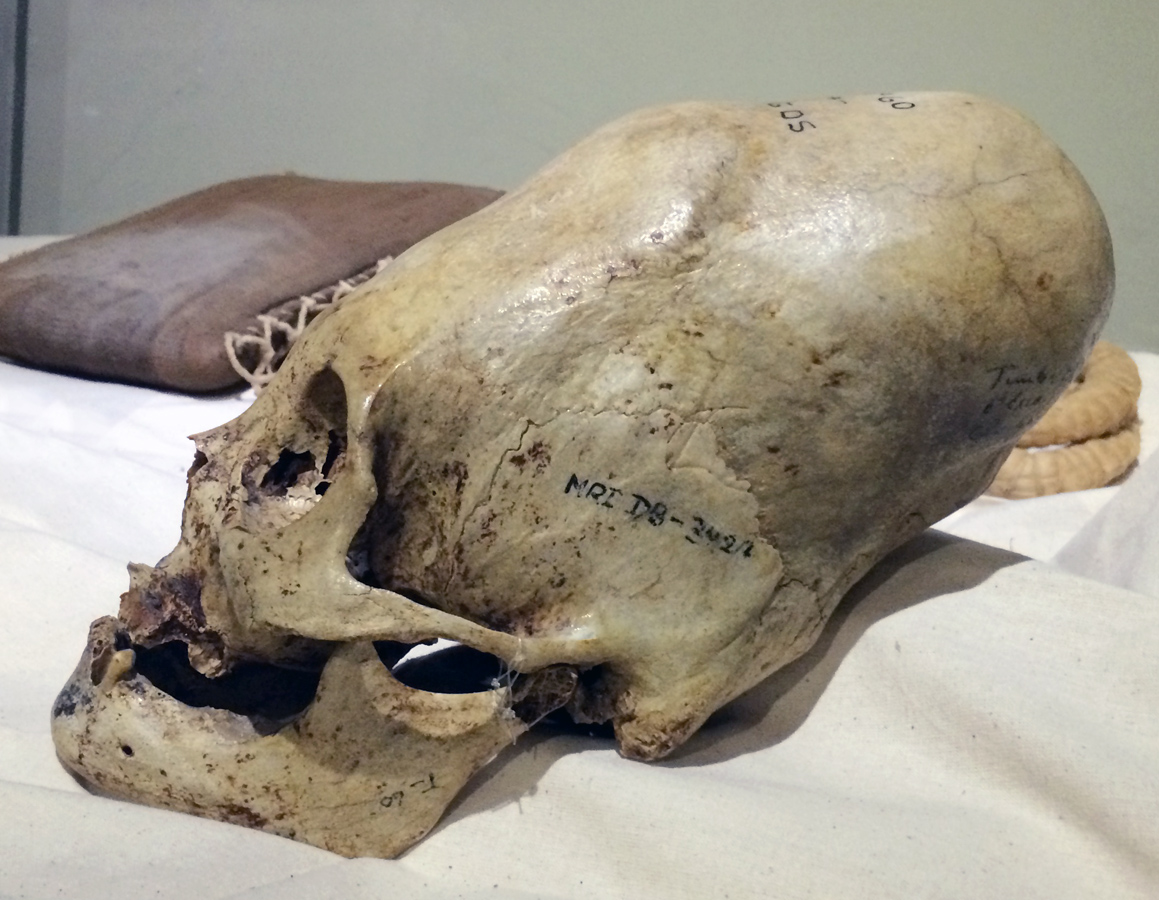 http://www.latinamericanstudies.org/paracas/paracas-skulls-6.jpg